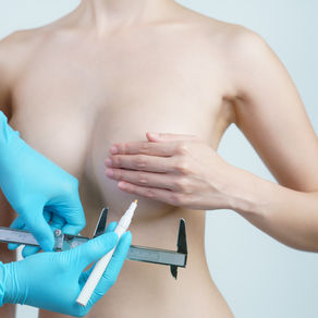 MEME (GÖĞÜS) KÜÇÜLTME ESTETİĞİ AMELİYATI OP DR GÖKHAN ÖZERDEM ANTALYA ESTETİK CERRAH